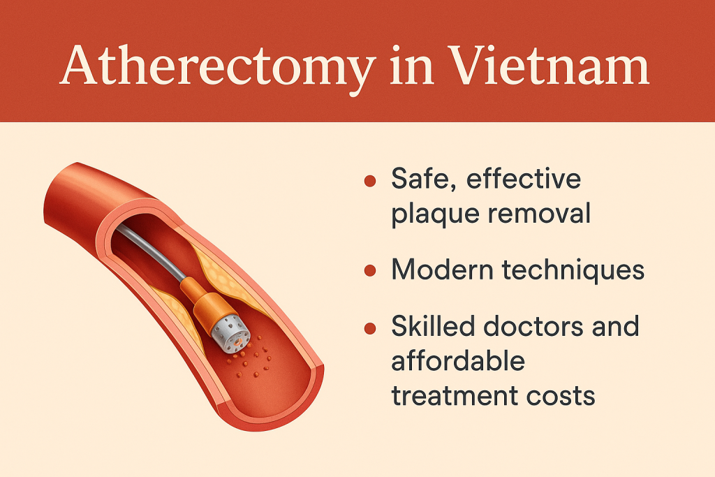 atherectomy in vietnam