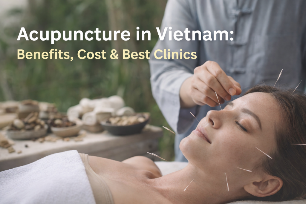 Acupuncture treatment in Vietnam performed by licensed traditional medicine doctor