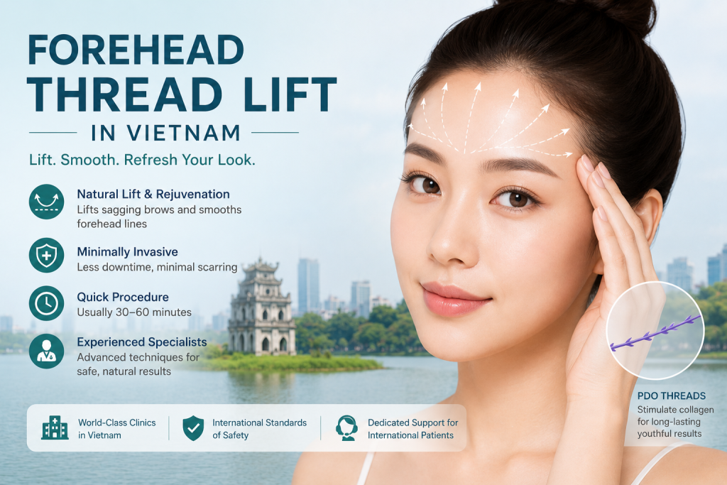 Forehead thread lift in Vietnam performed by cosmetic specialists using PDO threads for brow lifting and forehead rejuvenation with minimal downtime