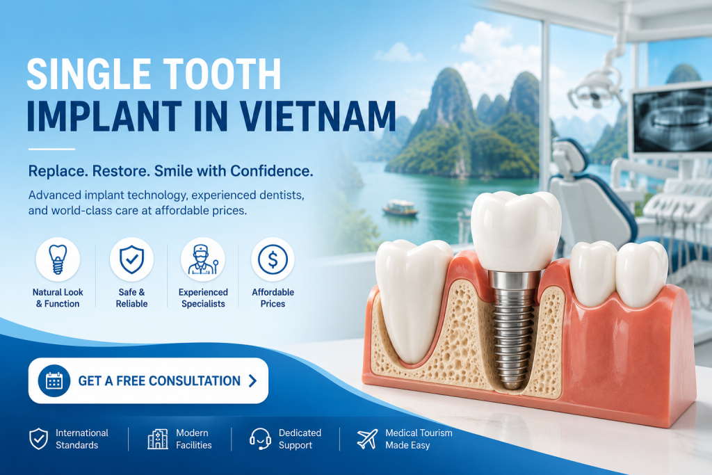 Single tooth implant in Vietnam with modern dental technology and affordable treatment options