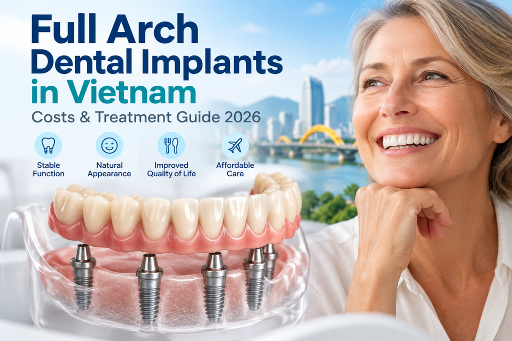 Full Arch Dental Implants in Vietnam